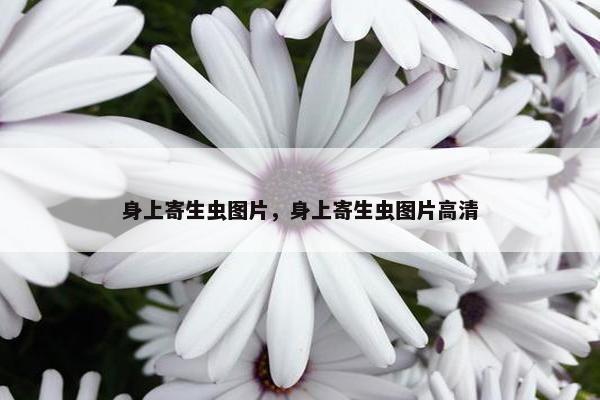 身上寄生虫图片，身上寄生虫图片高清
