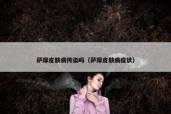 萨摩皮肤病传染吗（萨摩皮肤病症状）