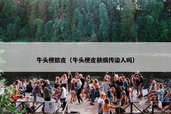 牛头梗脓皮(牛头梗皮肤病传染人吗) 牛头梗脓皮(牛头梗皮肤病传染人吗)