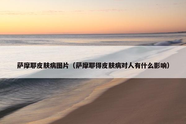 萨摩耶皮肤病图片（萨摩耶得皮肤病对人有什么影响）